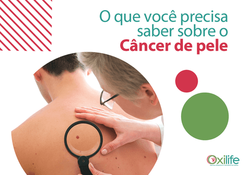 O que você precisa saber sobre o câncer de pele