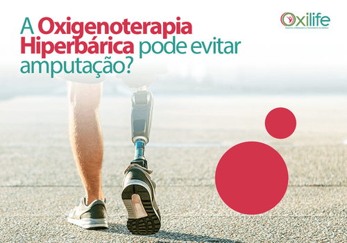 A Oxigenoterapia Hiperbárica pode evitar amputação?