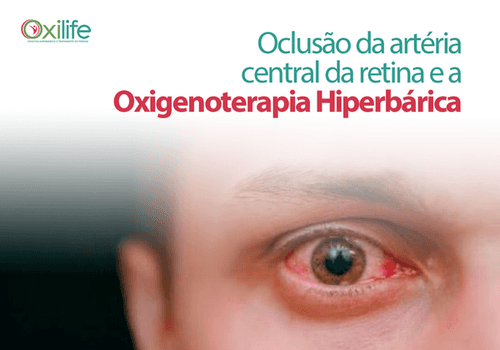 Oclusão da artéria central da retina e a Oxigenoterapia Hiperbárica