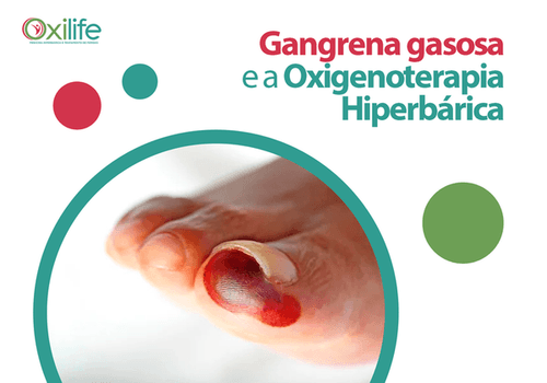 Gangrena gasosa e a Oxigenoterapia Hiperbárica
