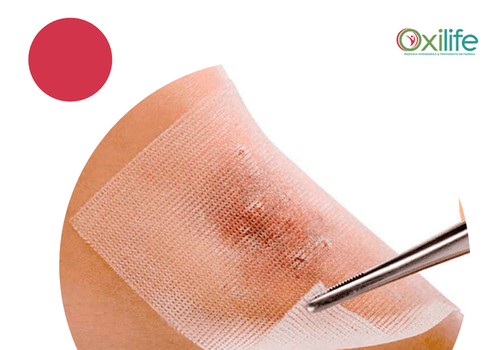 Quais as causas de uma ferida não estar cicatrizando?