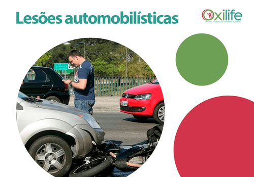 Lesões automobilísticas