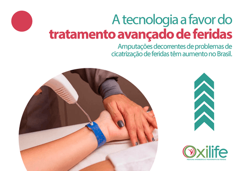 A tecnologia a favor do tratamento adequado de feridas