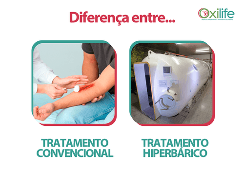 Diferença entre TRATAMENTO CONVENCIONAL E TRATAMENTO HIPERBÁRICO