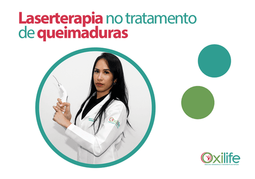 Laserterapia no tratamento de queimaduras