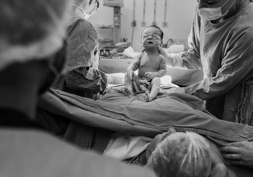 Como agendar a cobertura de nascimento com o Alba Estúdio