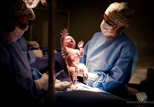NASCIMENTOS de Maria Laura | Fotografia de Nascimento | cesária