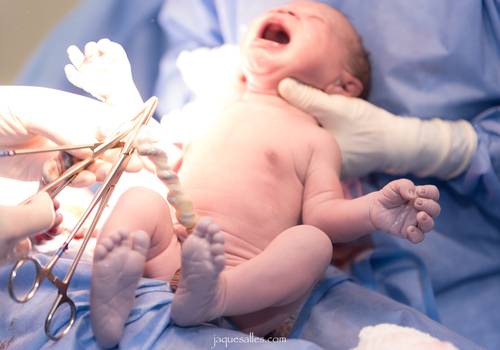 Parto de Fotografia de Parto | Perinatal Barra da Tijuca