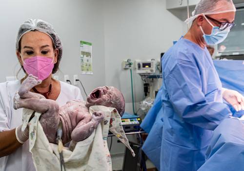 Parto de Fotografia de Parto | RJ Nascimento do Gustavo 