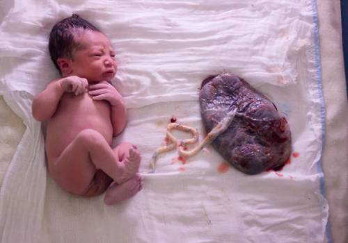 Partos /Nascimentos de Parto Domiciliar Sorocaba- Fernanda - Nascimento do Matheus