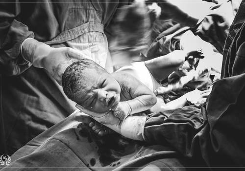 Parto de Nascimento do Murilo