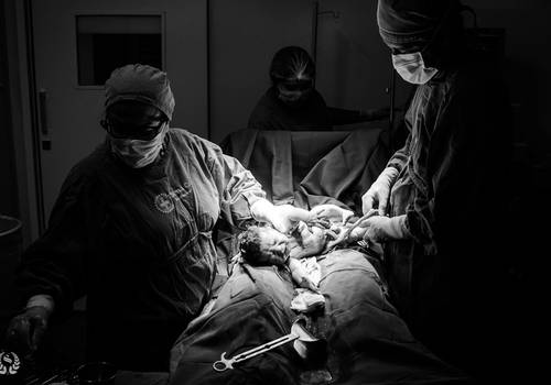 Parto de Nascimento de Davi Lucas