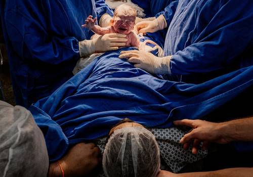 Parto de Fotografia de Parto - Cesárea - Nascimento Nina - Maternidade Curitiba