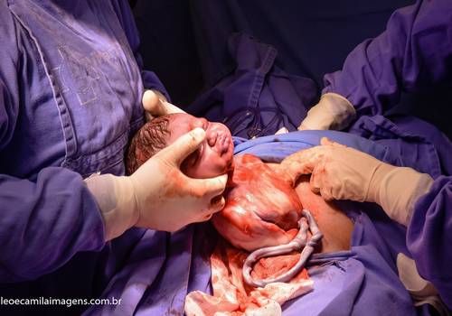 Parto de ANTONY JOSÉ