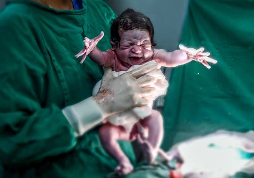 Casamentos de Fotografia de Parto 