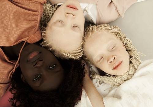 Gêmeas albinas e irmã negra viram modelos e impressionam por beleza