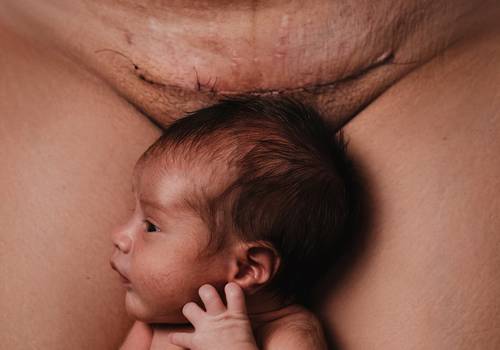 Retrato de Cicatrizes - Evelyn