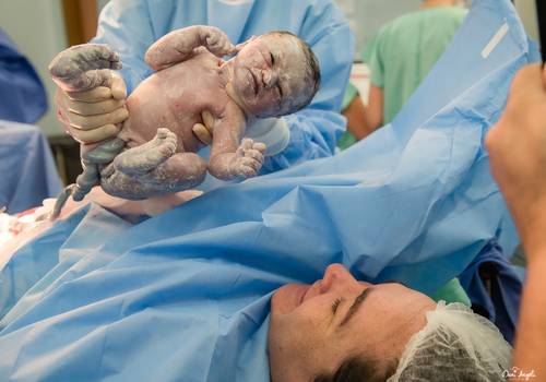 Documental de Parto de Nascimento Eduarda