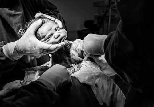 Parto de Nascimento Lívia - 16.12.2020