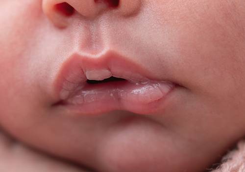 Newborn de Newborn - Elisa