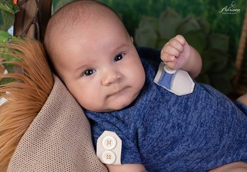 Acompanhamento de Samuel - 2 meses