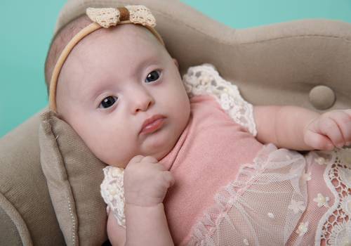 Acompanhamento de Ana Luiza - 2 meses