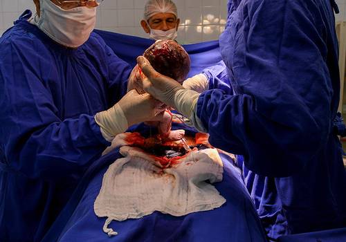 Parto de Nascimento {Heloísa}