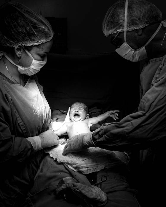 Parto/Nascimento de A chegada de Pietra