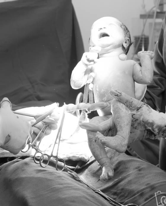 Parto de Fotografia de Parto