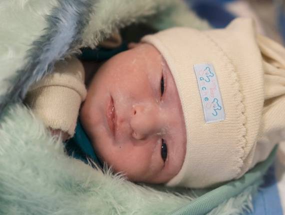 Parto Cesárea de Nascimento Henrique