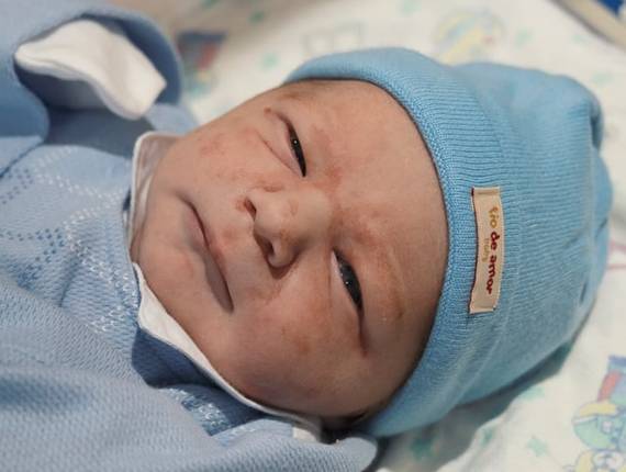 Parto Cesárea de Nascimento Arthur