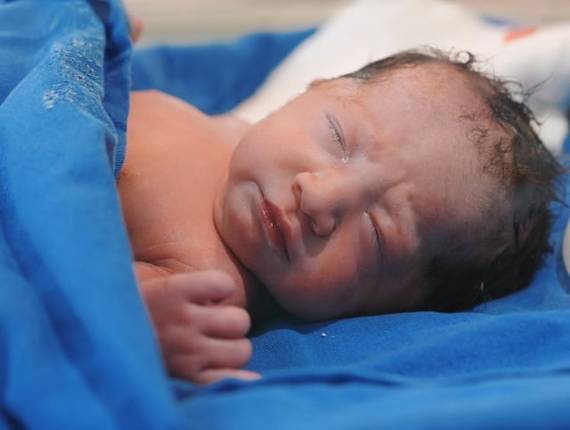 Parto Cesárea de Nascimento Gael Yori