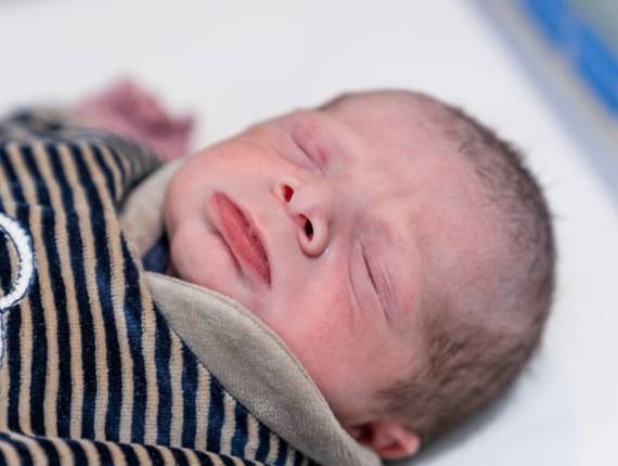 Parto Cesárea de Nascimento Bento