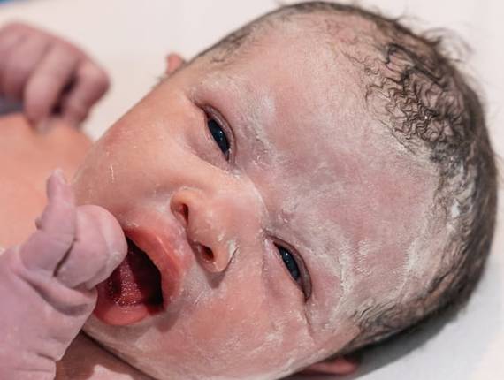 Parto Cesárea de Nascimento Manuela