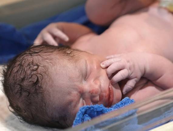 Parto Cesárea de Nascimento Pedro