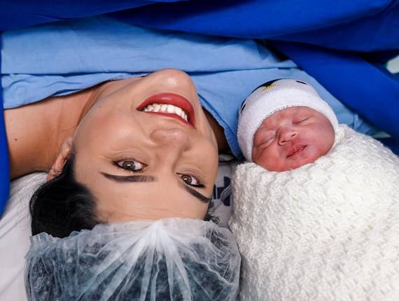 Parto Cesárea de Nascimento Murilo