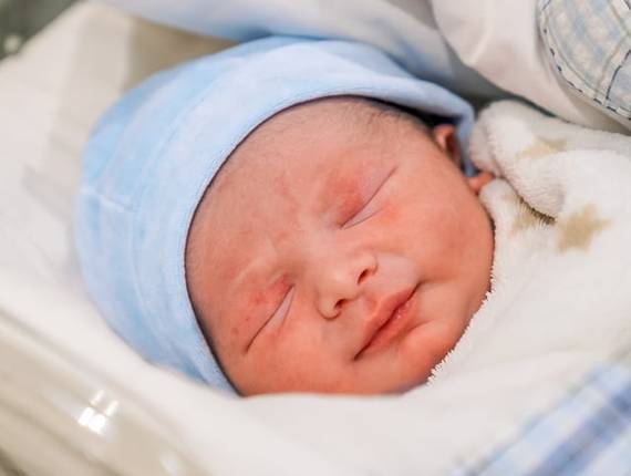 Parto Cesárea de Nascimento Lucas 