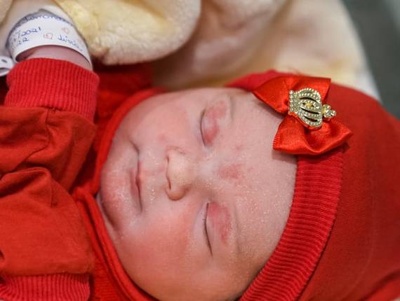 Parto Cesárea de Nascimento Lívia