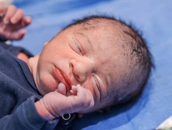 Parto Cesárea de Nascimento Lucas