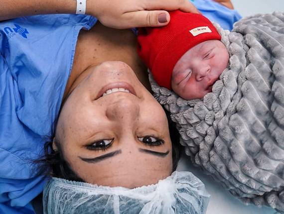 Parto Cesárea de Nascimento Théo