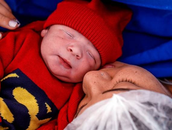 Parto Cesárea de Nascimento Miguel 