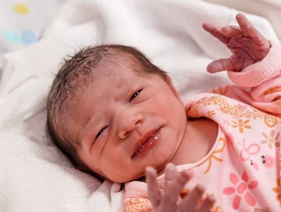 Parto Cesárea de Nascimento Allana 