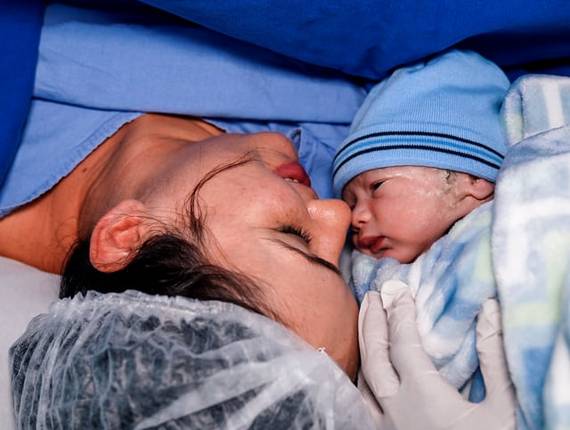 Parto Cesárea de Nascimento Pedro