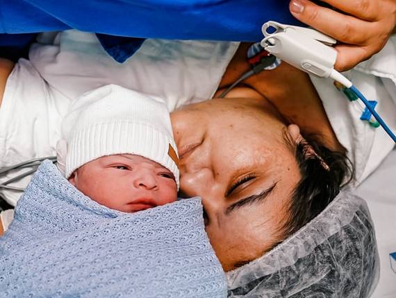 Parto Cesárea de Nascimento Marco Antônio