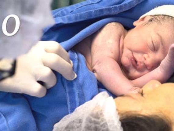 Parto Cesárea de Nascimento Théo