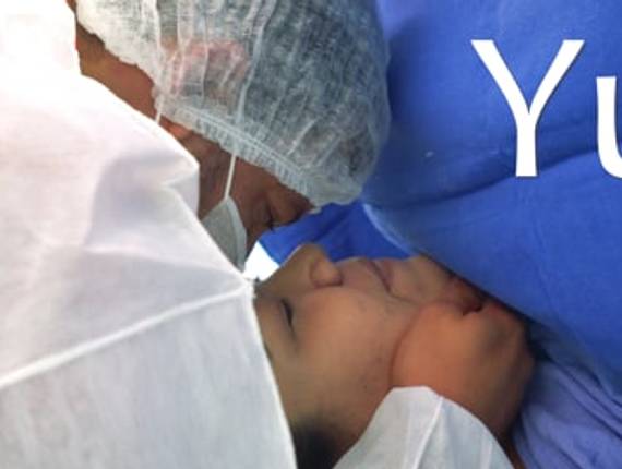 Parto Cesárea de Nascimento Yuri