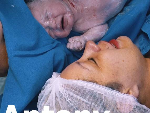 Parto Cesárea de Nascimento Antony