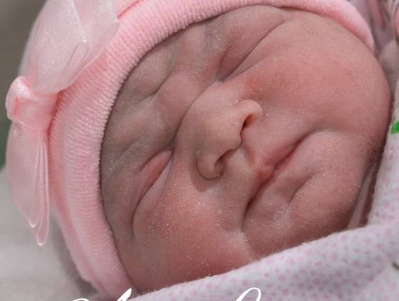 Parto Cesárea de Nascimento Ana Luiza