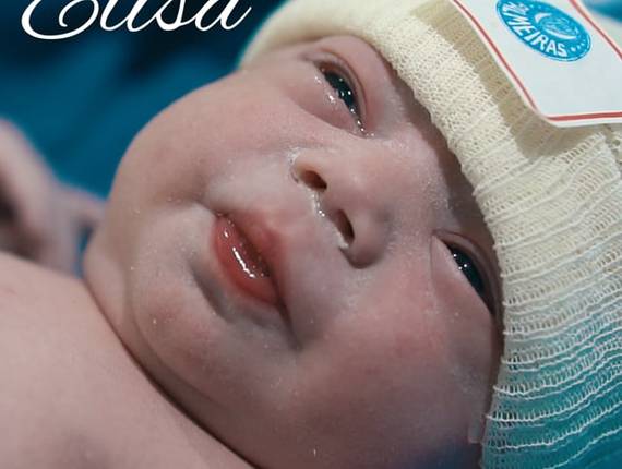 Parto Cesárea de Nascimento Elisa 