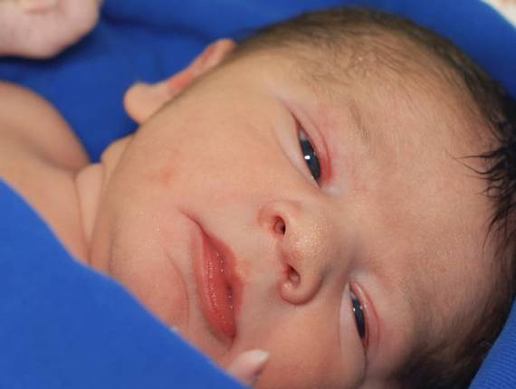 Parto Cesárea de Nascimento Eduardo Gabriel